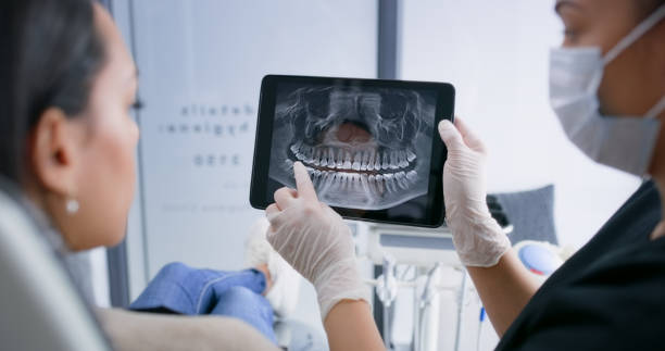 Licensed Wisdom Tooth Removal service in Canton, OH - Smile Center Dentistry